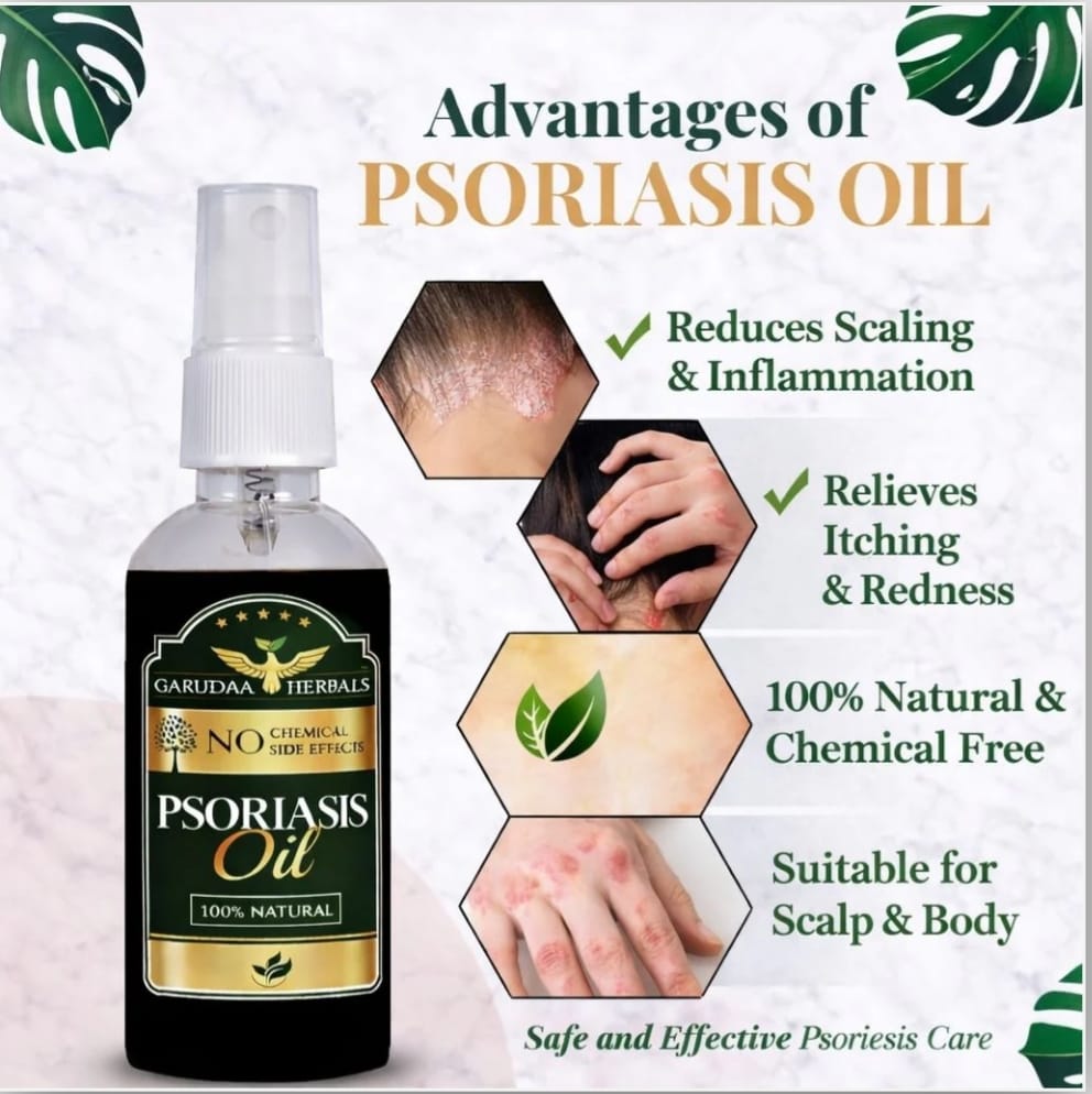 Psoriasis Herbal Oil